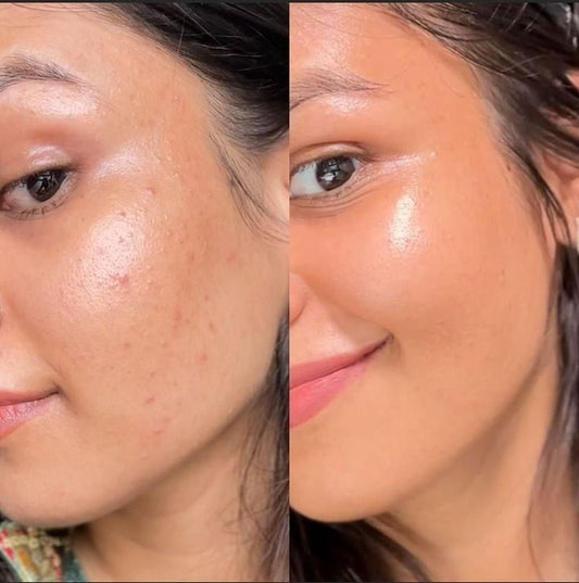 Retinol Renewal Serum – Youthful, Hydrated Skin